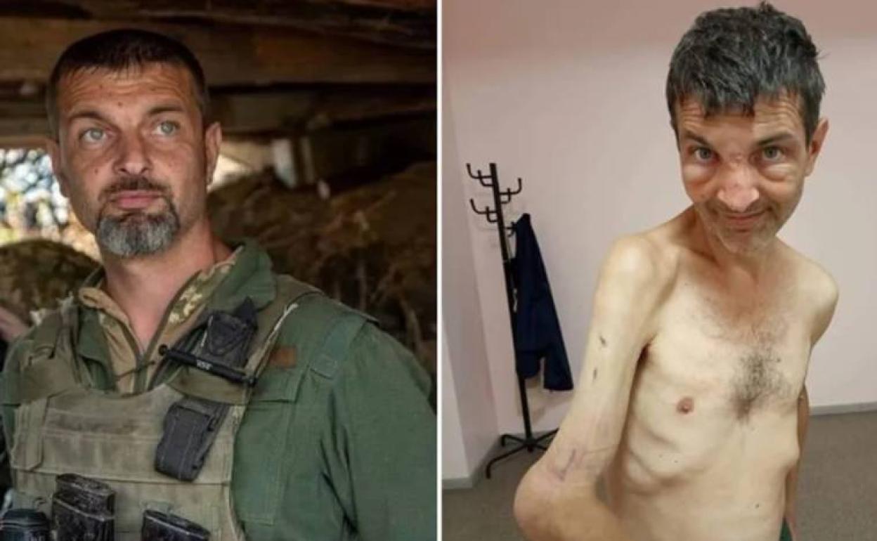 Las fotos del antes y el después de un soldado ucraniano liberado que